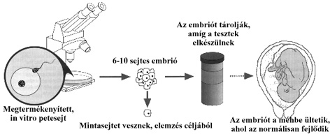 beltets eltti diagnzis, in vitro megtermkenyts